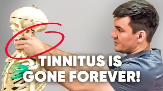 3 main causes of tinnitus Did this and everything passed [upl. by Atikin]