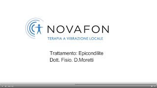 Trattamento Epicondilite con NOVAFON power  Testina Magnetica [upl. by Redmond]