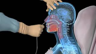 How to insert a nasogastric tube for NG intubation  3d animation [upl. by Greggs]