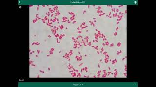 escherichia coli  الإشريكية القولونية [upl. by Esteban48]