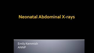 Abdominal Xrays 1 of 2 [upl. by Eveivenej]