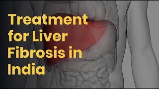 Liver Fibrosis Treatment in India  Treatment for Liver Fibrosis  Lyfboat [upl. by Granniah122]