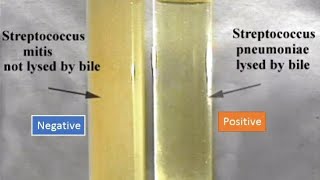 How to Do a Beet Flow Flush to Improve Bile Flow [upl. by Enuahs]