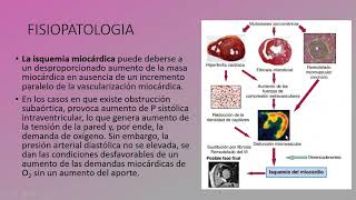 Miocardiopatía Hipertrófica [upl. by Esmerolda244]