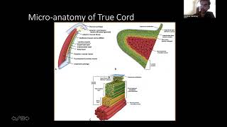 Applied Anatomy Of Larynx And Hypopharynx Dr Shikhar Sawhney [upl. by Nnaeiluj]