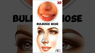 Bulbous Nose  medical animation 3d short  BiologywithAliya [upl. by Latona]