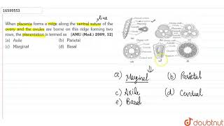 Wheb placenta forms a ridge along the ventral suture of the ovary and the ovules are borne [upl. by Harrietta113]