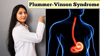 PlummerVinson Syndrome in Hindi  Detail Explanation With Notes  Causes Symptoms Treatment [upl. by Eidolem]