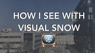 VISUAL SNOW Simulation  What I see during daytime static tinnitus visual disturbance [upl. by Patrich]