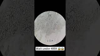 Pimples at 400X magnification are really cool underthemicroscope beefcut scienceshorts [upl. by Notnilk]