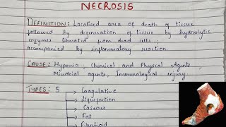 What Is Necrosis  Types Of Necrosis  Gross amp Microscopy  Pathology [upl. by Atteuqehs703]