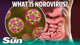 What is norovirus and how long does sickness bug last [upl. by High]