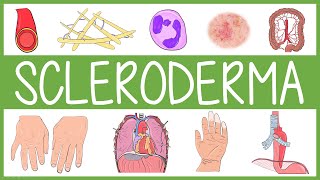 Scleroderma [upl. by Ameekahs]