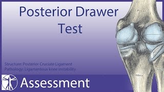 Posterior Drawer Test  Posterior Cruciate Ligament [upl. by Yeroc]