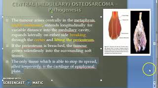 Pathology 828 c OsteoSarcoma Pathogenesis Clinical Metaphysis Bone ALP Sunburst Pattern Codman [upl. by Kcirb]