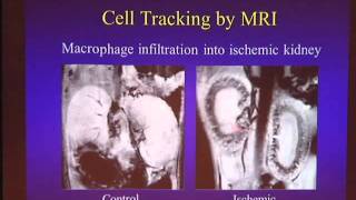 Tracking Single Cells in the Brain with Alan Koretsky PhD  RSDSA [upl. by Elda]