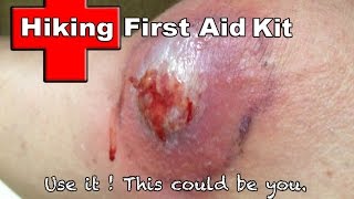 Hiking First Aid Kit  Use it or Else [upl. by Dame]