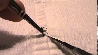 How to Remove Sutures [upl. by Ricki]