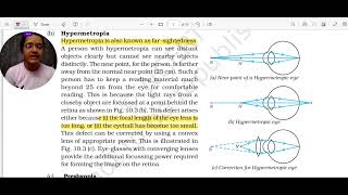 10thCBSEState Physics Chapter10 Defects of vision Myopia Hypermetropia and Presbyopia [upl. by Norrahc]