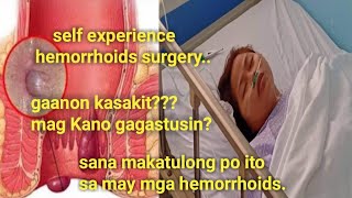 hemorrhoidectomy surgery Gaano kasakit magkano Ang gastos [upl. by Ynos]