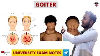 Goitre  Hypothyroidism amp Hyperthyroidism  Endocrine Physiology [upl. by Tripp399]