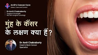 मुंह के कैंसर के लक्षण क्या हैं  What are the Symptoms of Mouth Cancer  Dr Amit Chakraborty [upl. by Mellen]