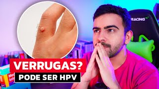 Sintomas do HPV │ Prevenção e Tratamento do PAPILOMA VIRUS HUMANO [upl. by Anyahs]