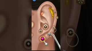 Asmr ear wax removal asmr asmrvideo shorts earringsanimation [upl. by Llenrag964]