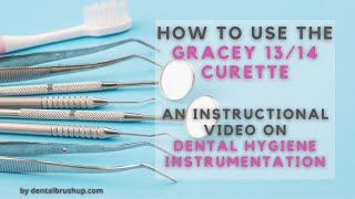 How to use the Gracey 1314 Curette [upl. by Selma]