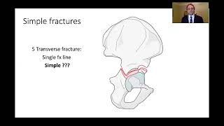 Kasr Al Ainy Postgraduate Orthopaedic Review Course  Acetabular Fractures Principles of Management [upl. by Orson]