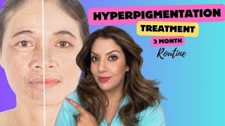 Hyperpigmentation treatment at home  Nipun Kapur [upl. by Irtimd]