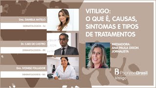 Vitiligo O que é Causas sintomas tipos e tratamentos  Live [upl. by Conyers]