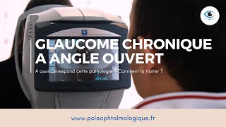 Glaucome chronique à angle ouvert Pole Ophtalmologique [upl. by Spillar]