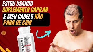 Cabelo Caindo Mesmo com Foligain O Que Fazer [upl. by Stanley]