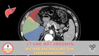 Schnittbildgebung des Abdomens  Wie war das noch mit den Lebersegmenten [upl. by Olifoet]