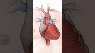 Coronary Angioplasty with Stent Placement heartdoctor interventionalcardiologist cardiovascularsu [upl. by Piwowar]