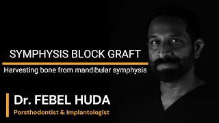 SYMPHYSIS BLOCK BONE GRAFT [upl. by Hearsh]