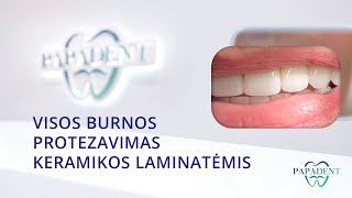 Visos burnos protezavimas keramikos laminatėmis [upl. by Ettelloc]