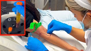 Phlebotomy Procedure for PRP  Venipuncture with Butterfly needle in 2023 [upl. by Etsirk601]