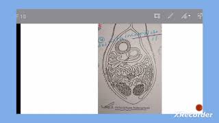 lecture 6  heterophyes heterophyes [upl. by Gardener]