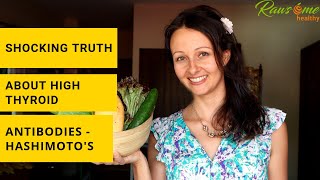 The Shocking Truth About Hashimotos  High Thyroid Antibodies [upl. by Fauch200]