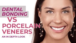 Dental Bonding VS Porcelain Veneers  An In Depth Look Reuben Sim [upl. by Nimocks497]