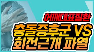 어깨 대표 질환 회전근개 파열 VS 충돌증후군 두 질환의 차이점은 [upl. by Concordia]