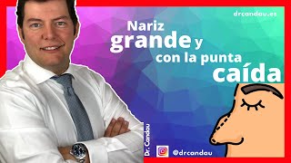 Rinoplastia Ultrasónica Ambulatoria  Nariz grande y con la punta caida [upl. by Bella]