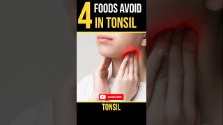 Top 4 foods avoid in tonsil  foods avoid in tonsil tonsil short fyp [upl. by Bruis770]