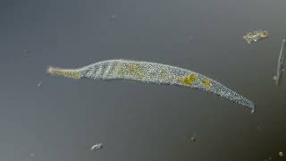 Interstitial Ciliates  Jaffa port [upl. by Moody]