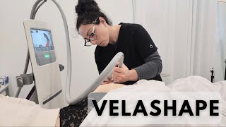 Shape Up with VelaShape III Your Ultimate Guide to Body Contouring [upl. by Redmer]