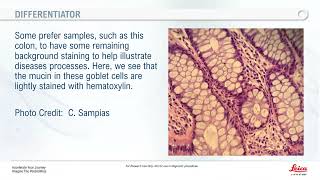 Fundamentals of Hematoxylin and Eosin Staining [upl. by Eecak]