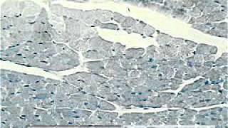 Stratified flat Epithelium sec under microscope [upl. by Viens]