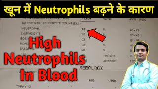 High Neutrophil Count in blood test  high neutrophils in blood  neutrophil count  neutrophils [upl. by Arte]